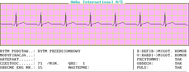 EKG wykresy z łyżek, Pierwsza Pomoc - c15-0.png